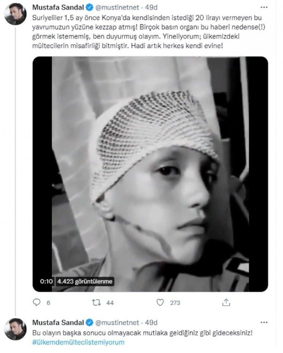 Suriyeliler küçük çocuğa kezzap attı iddiası yalan çıktı