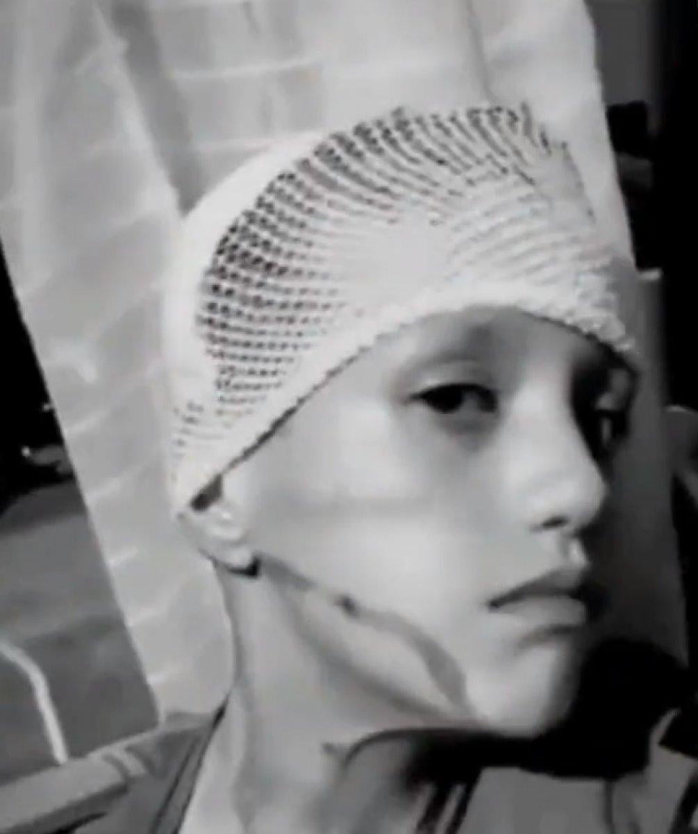 'Suriyeliler çocuğun yüzüne kezzap attı' iddiası ortalığı karıştırdı