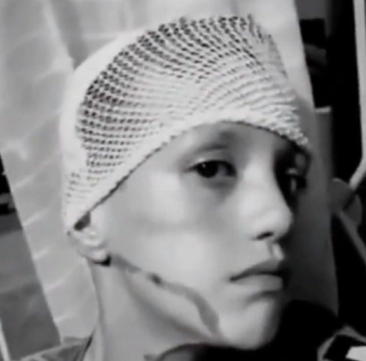 Suriyeliler küçük çocuğa kezzap attı iddiası yalan çıktı