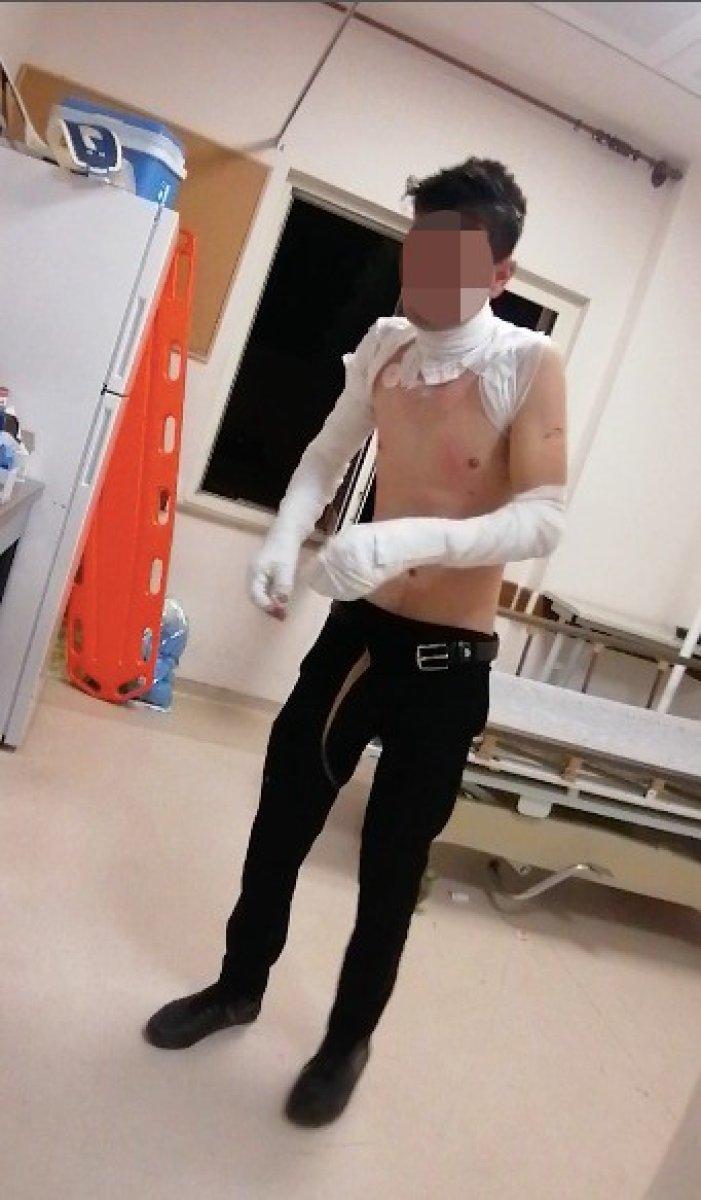 Antalya'da ambulans geç geldi deyip kendini yaktı