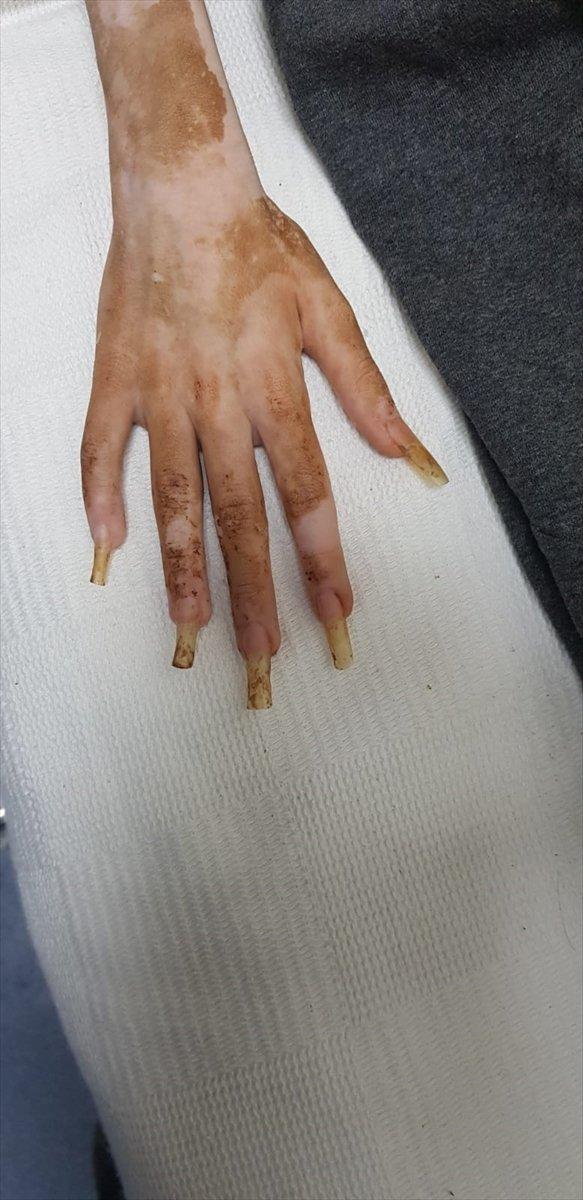 Bursa'da yeğenini çöp evde kilitli tutan kadın gözaltına alındı