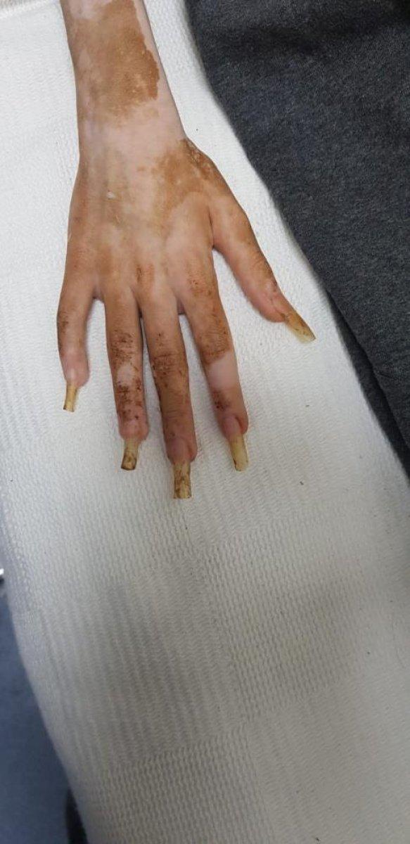 Bursa'da esnaf, çöp evde bulunan çocuğun teyzesini anlattı