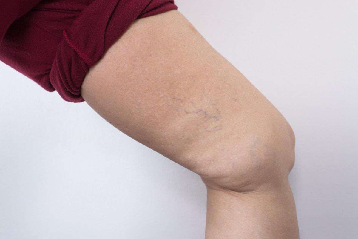 Vücuttaki su tutulmasını azaltan en iyi 12 gıda