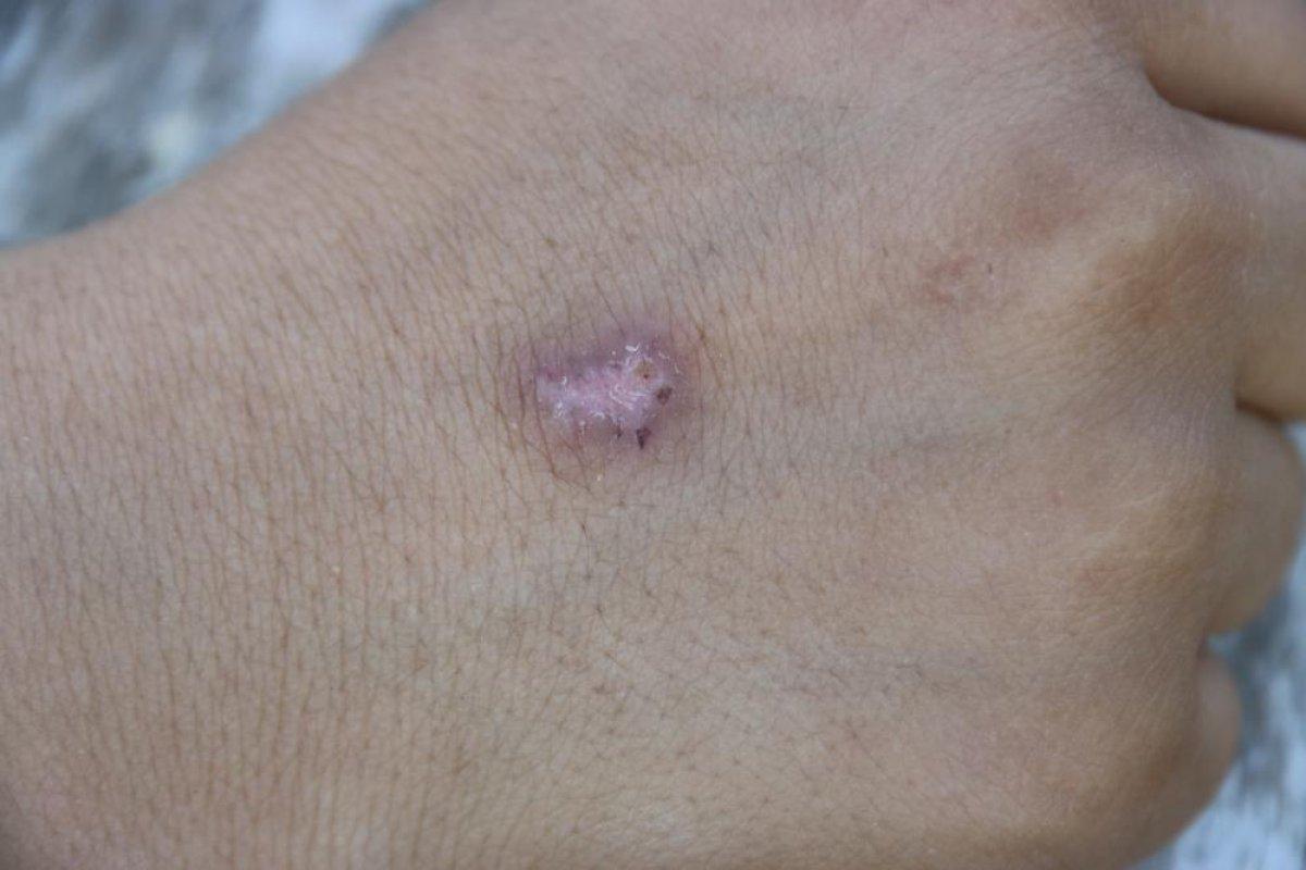 Diyarbakır'da eski eşinin, oğlunun üzerinde sigara söndürdüğünü iddia etti