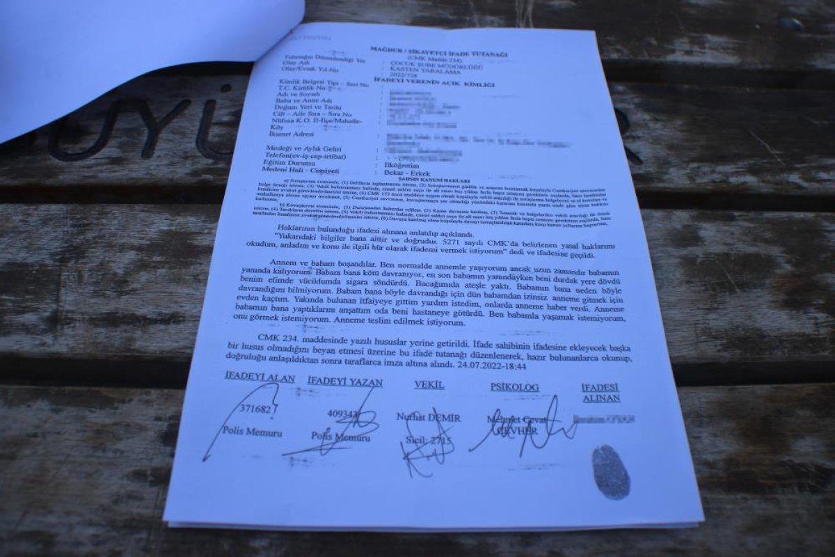 Diyarbakır'da eski eşinin, oğlunun üzerinde sigara söndürdüğünü iddia etti