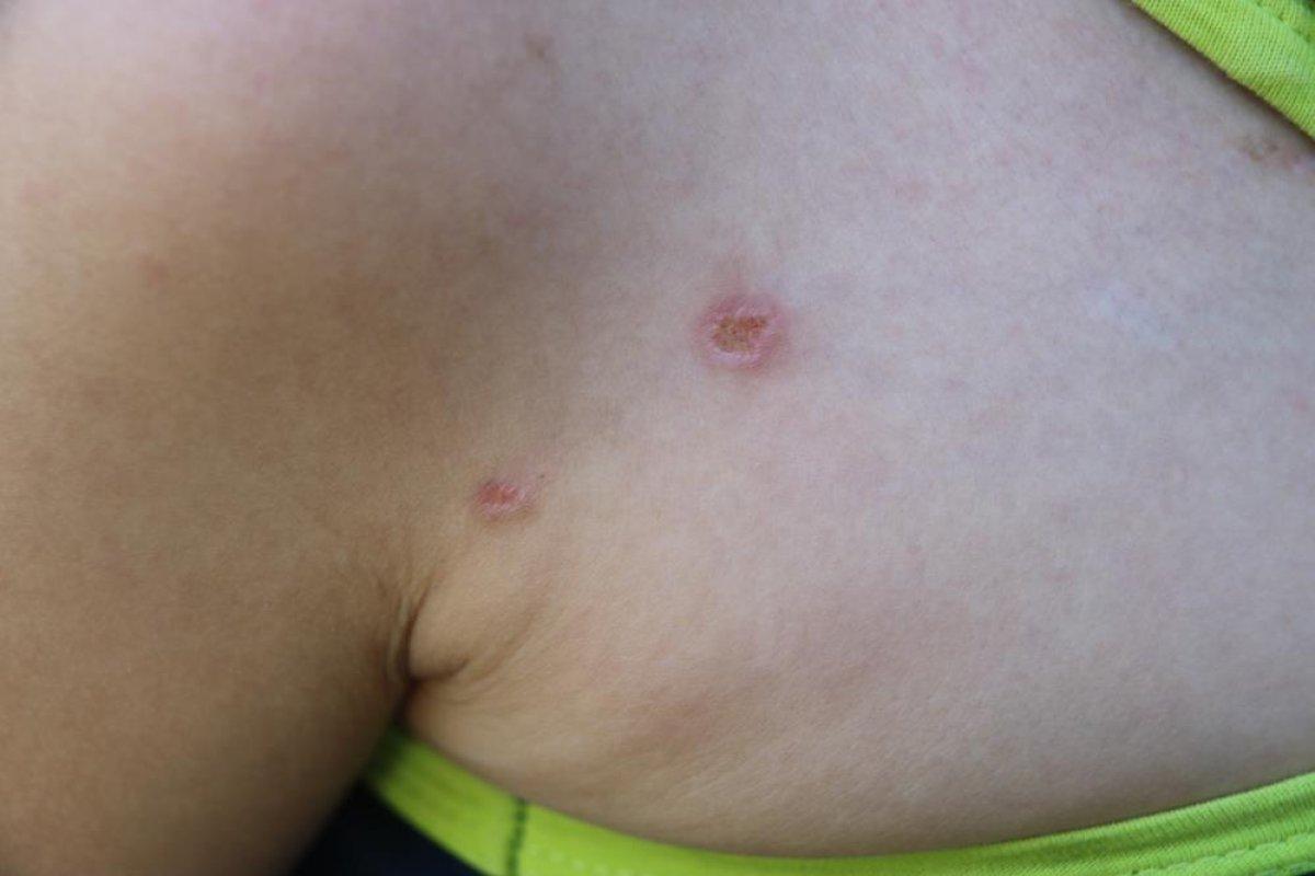 Diyarbakır'da eski eşinin, oğlunun üzerinde sigara söndürdüğünü iddia etti