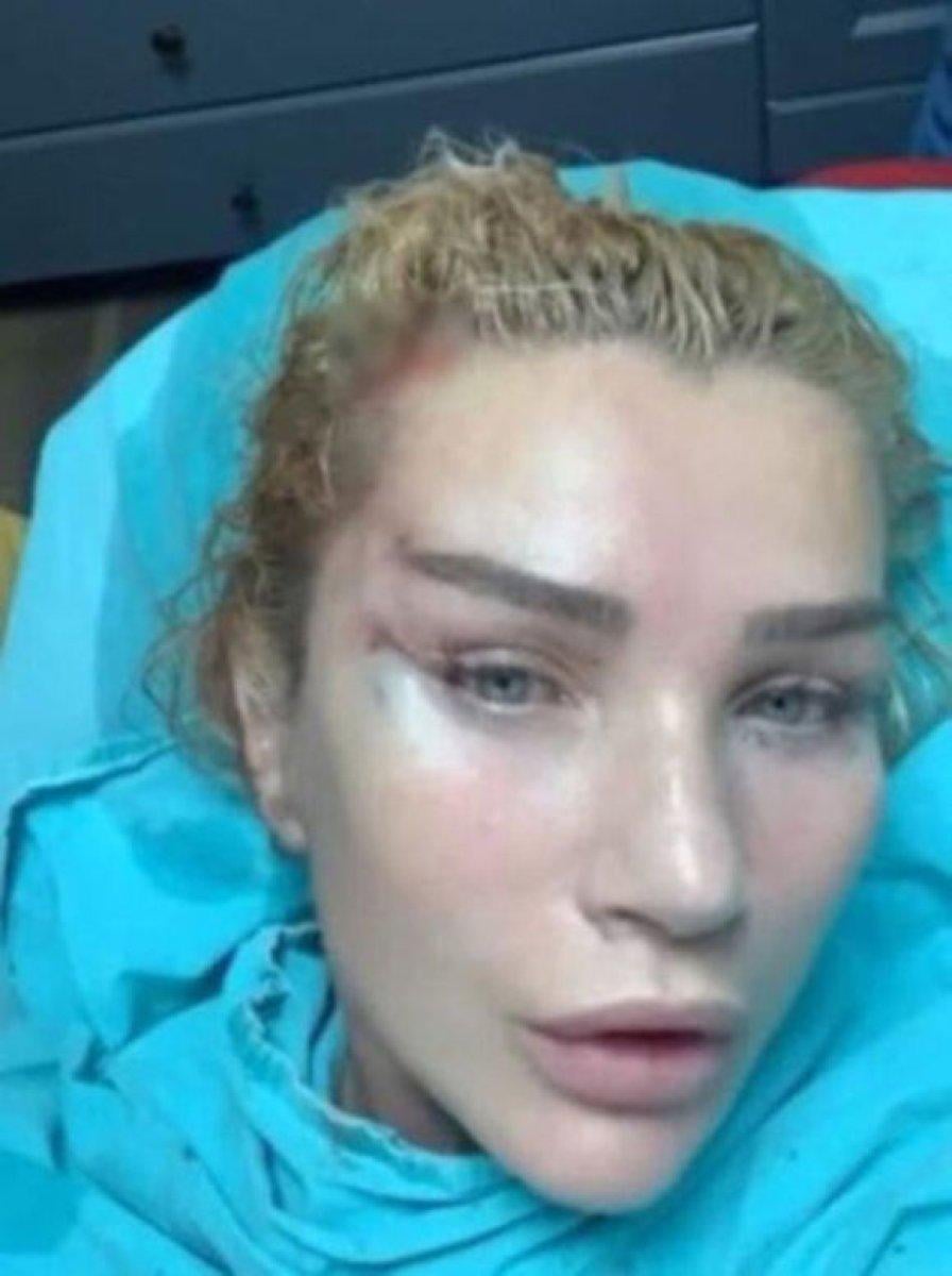 Esra Dermancıoğlu'ndan estetik önerisi