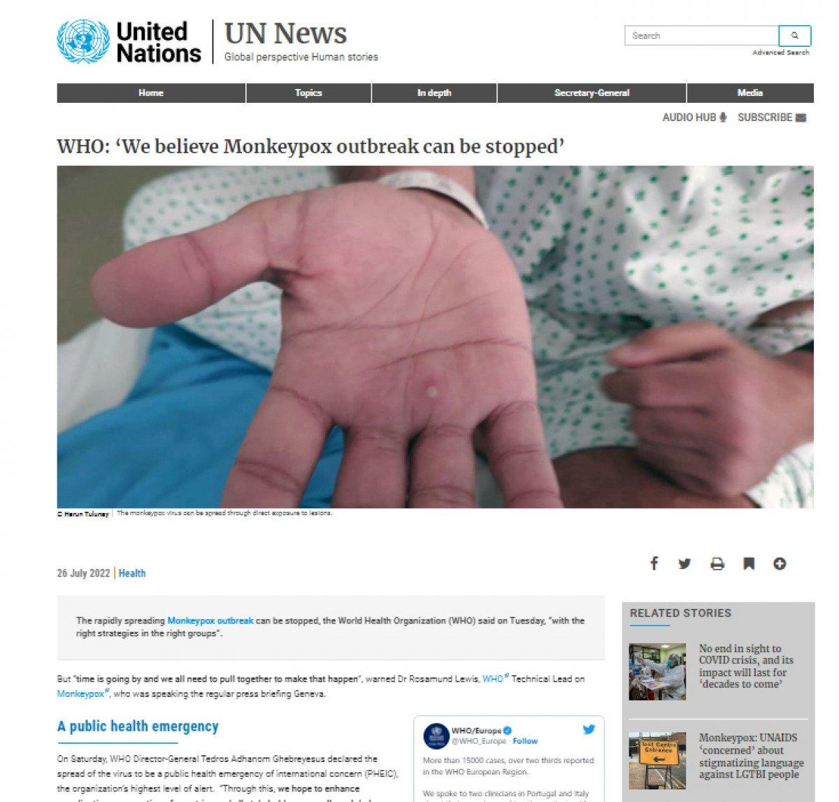 HIV, koronavirüs ve maymun çiçeğini geçirdi, damgalanmaktan kurtulamadı