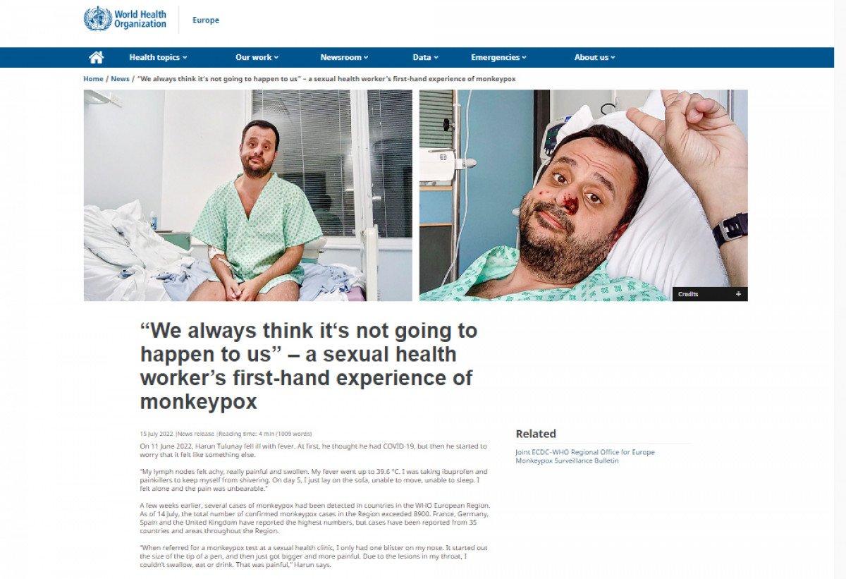 HIV, koronavirüs ve maymun çiçeğini geçirdi, damgalanmaktan kurtulamadı