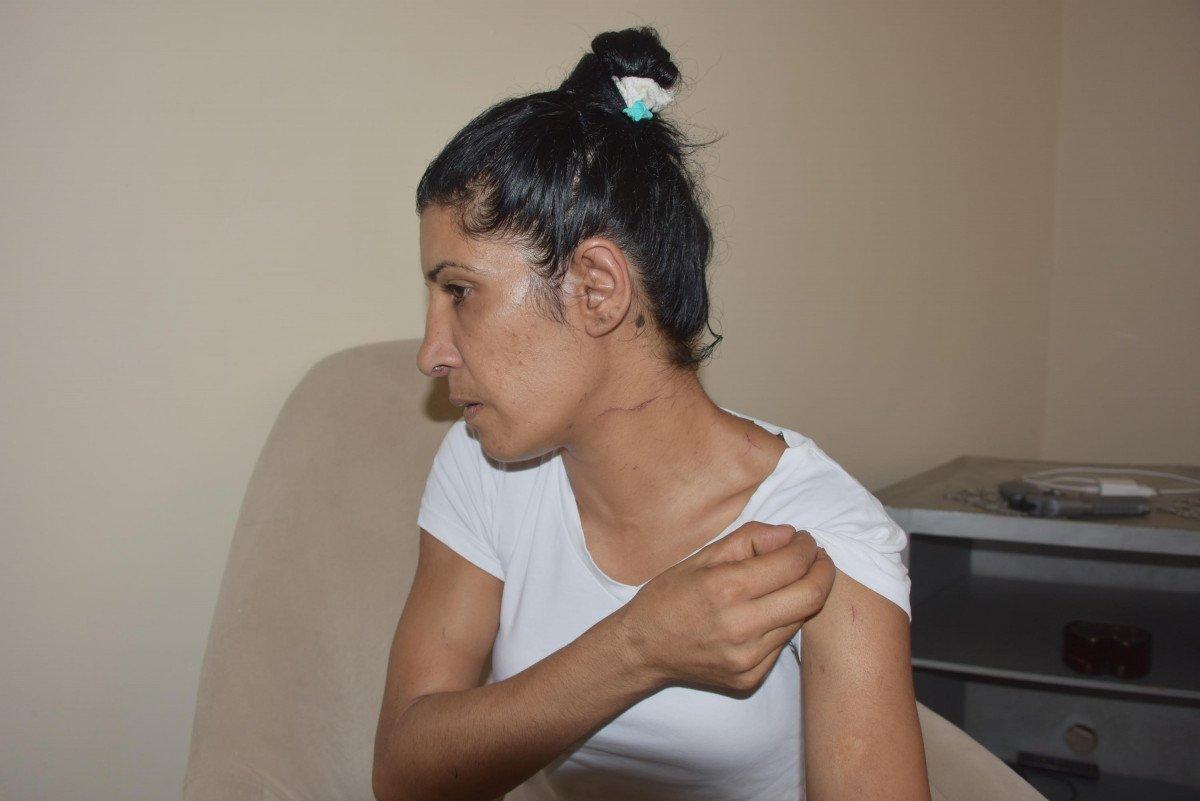 İzmir'de eşi tarafından bıçakla rehin alınan kadın, yaşadıklarını anlattı