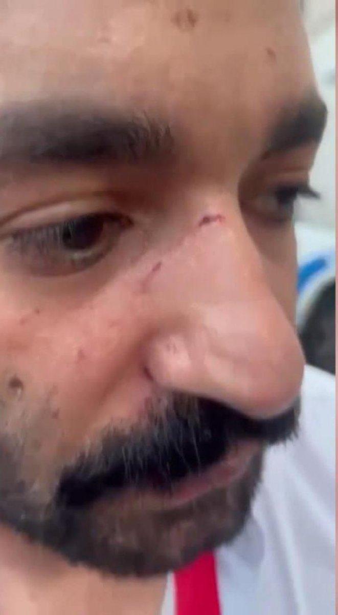 Manuel Fernandes, gazeteciye saldırdı