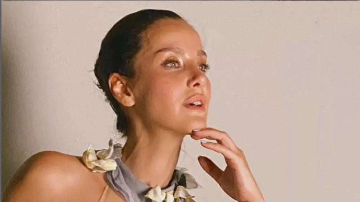 İrem Helvacıoğlu estetik yaptırdı