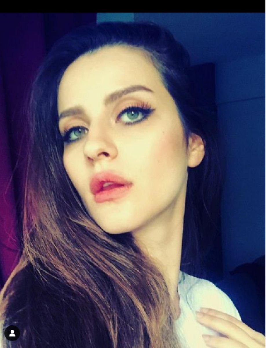 İrem Helvacıoğlu estetik yaptırdı