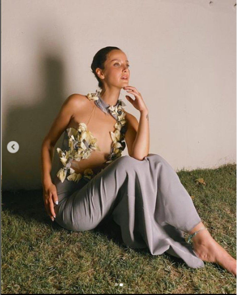 İrem Helvacıoğlu estetik yaptırdı