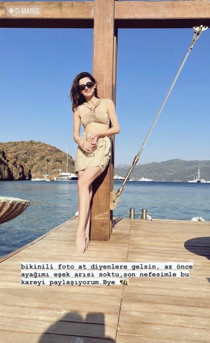 Nesrin Cavadzade'yi eşek arısı soktu