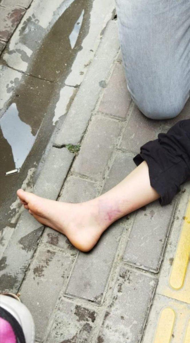 Kastamonu'da sokak köpeğinden kaçan kızın ayağını otomobil ezdi