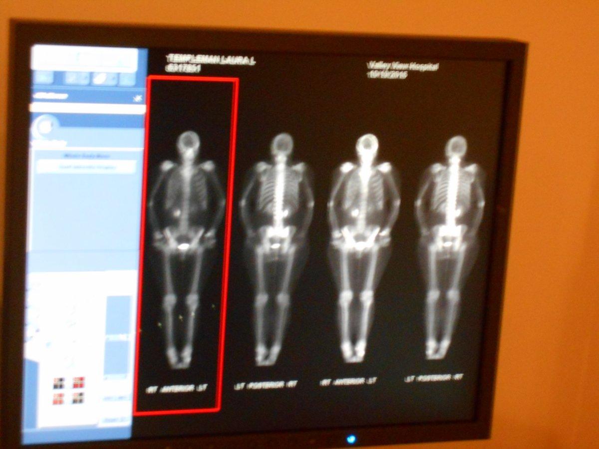 Kemik sağlığı için kalsiyum zengini en iyi 13 gıda