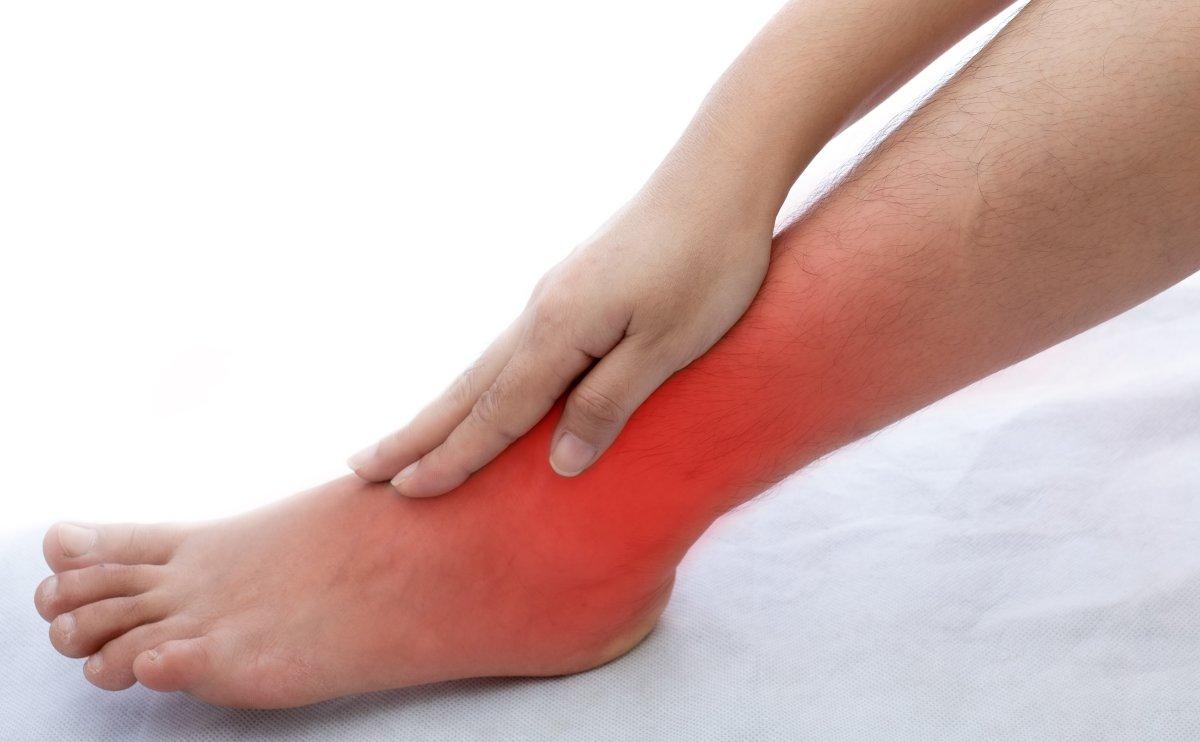 Gece yatarken ayak yanması neden olur? Yanan ayak sendromunun nedenleri ve tedavi için ipuçları