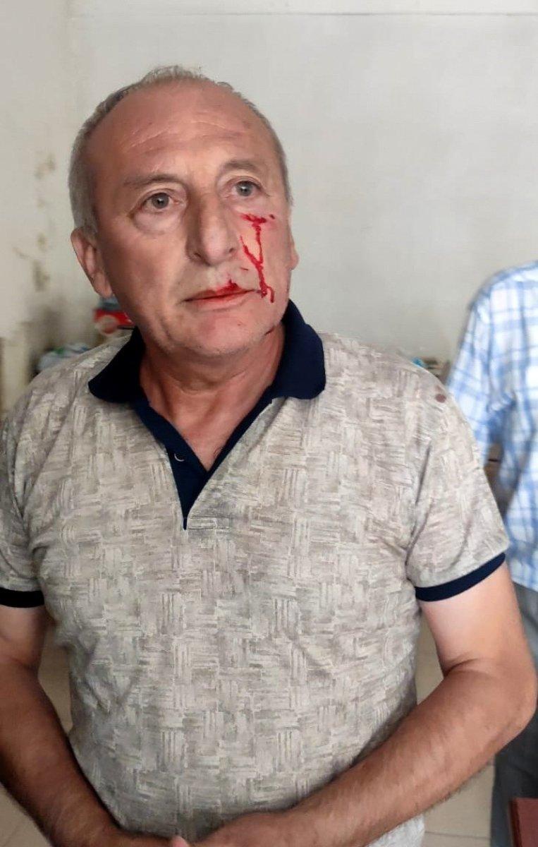 Yarbaşı Belediye Başkanı Mustafa Kaynar, dayısının saldırısına uğradı