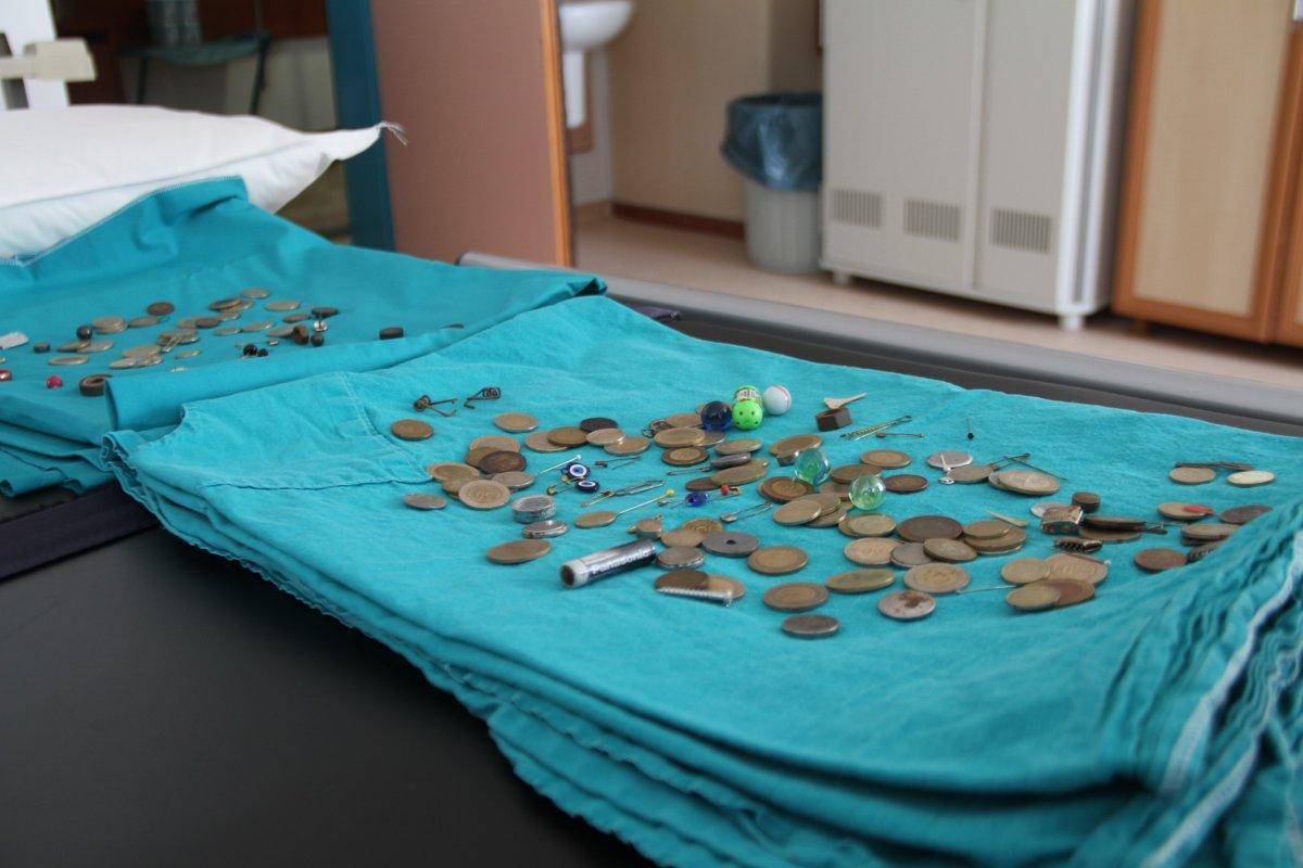 Elazığ’da çocukların midesinden çıkan yabancı cisimler şaşırttı