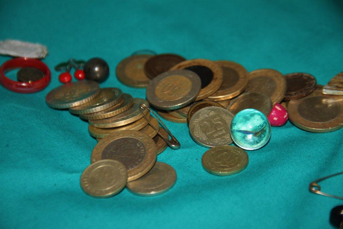 Elazığ’da çocukların midesinden çıkan yabancı cisimler şaşırttı