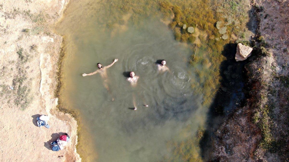 Sivas’taki gölün uyuzlara iyi geldiği iddia ediliyor