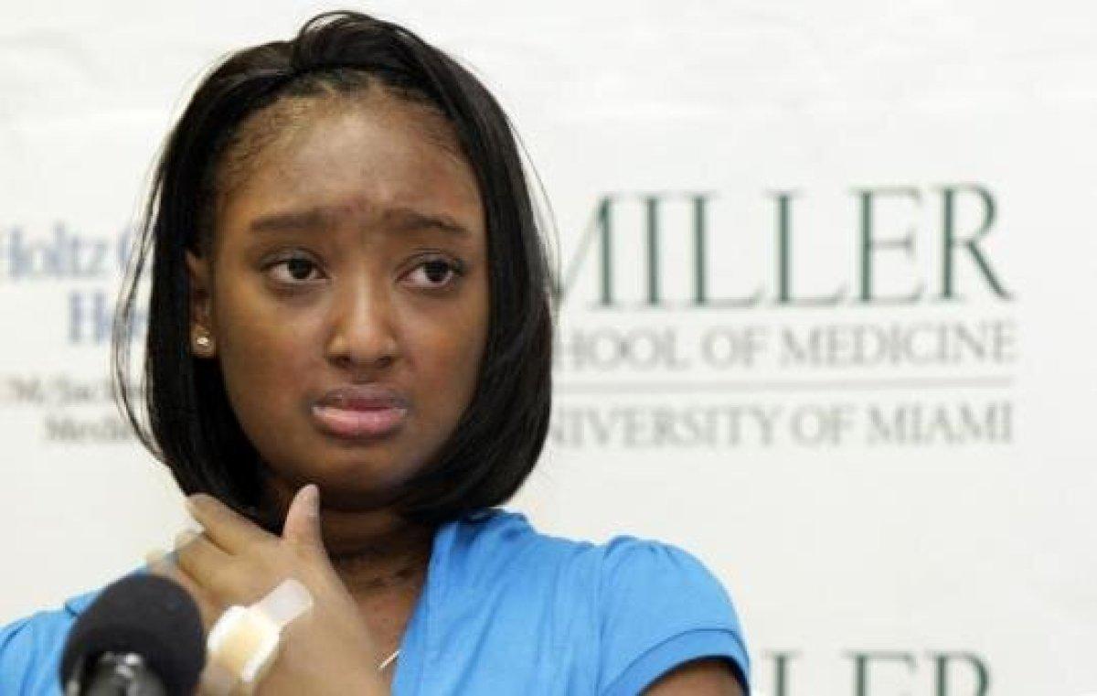 Kalbi olmadan 118 gün yaşadı! D’Zhana Simmons'ın inanılmaz hikayesi..