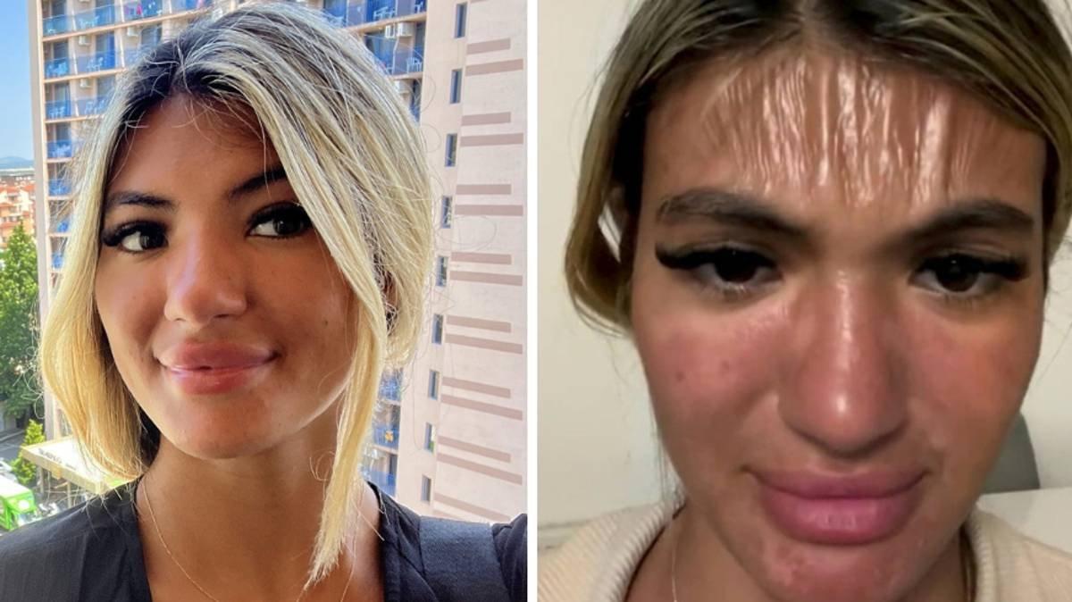 Güneşin altında uyuyan İngiliz kadının yüzündeki çarpıcı değişim