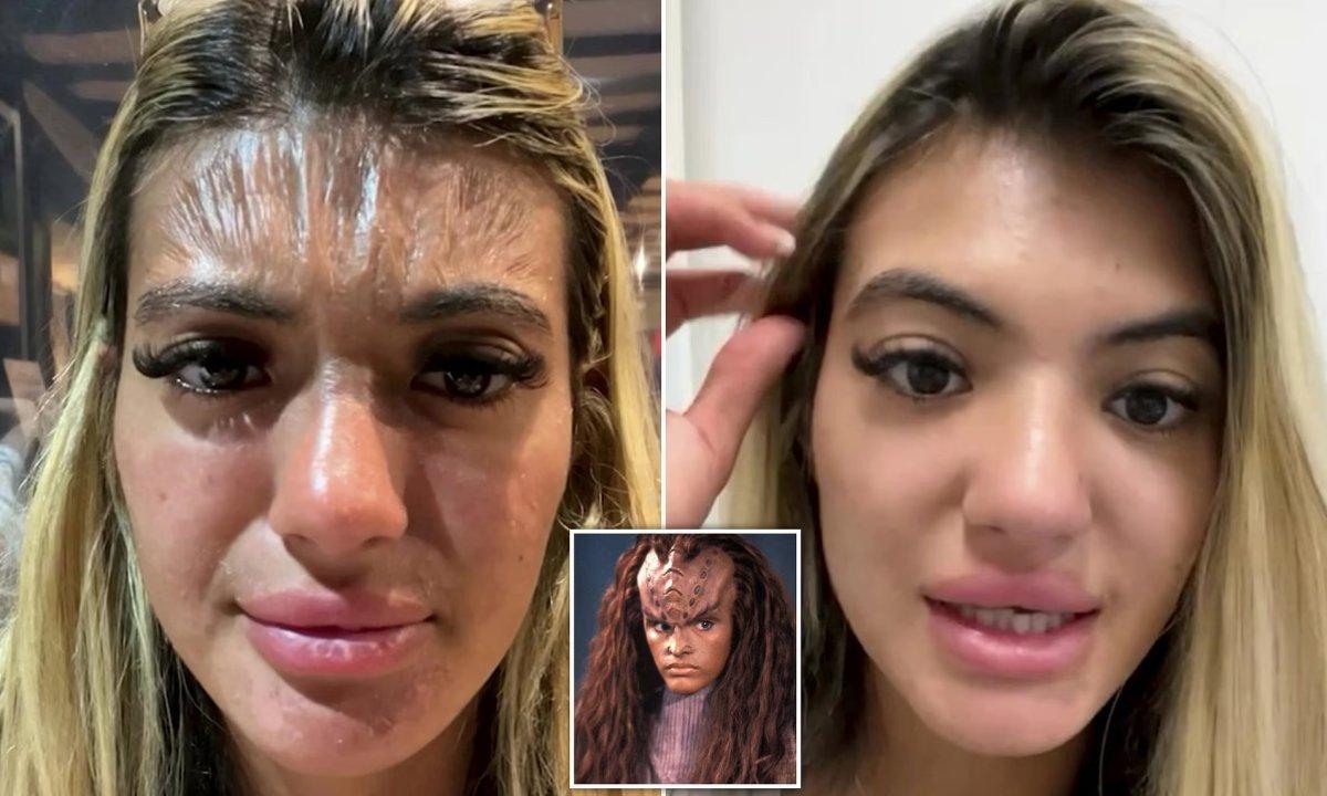 Güneşin altında uyuyan İngiliz kadının yüzündeki çarpıcı değişim