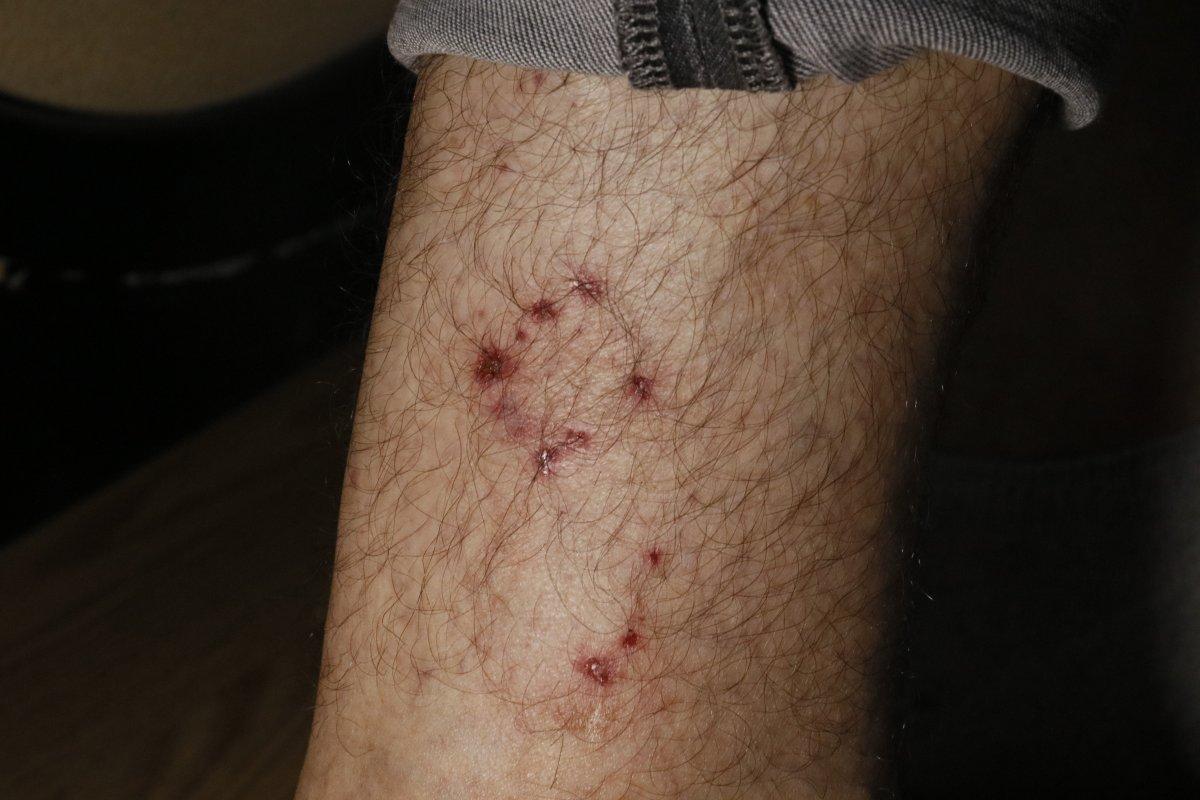 Adana'da başıboş köpeler, ailesiyle eve dönen motosikletliye saldırdı