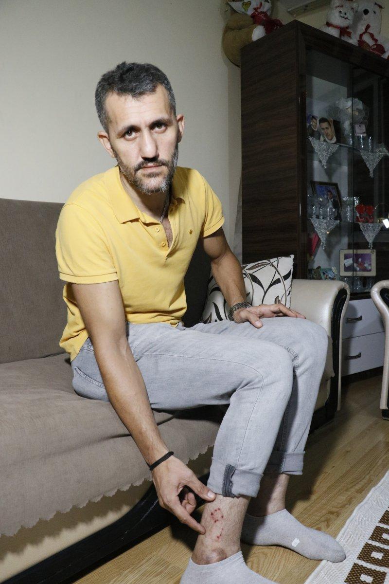 Adana'da başıboş köpeler, ailesiyle eve dönen motosikletliye saldırdı