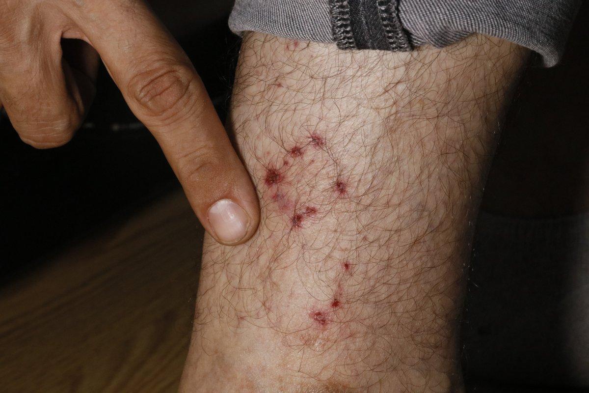 Adana'da başıboş köpeler, ailesiyle eve dönen motosikletliye saldırdı
