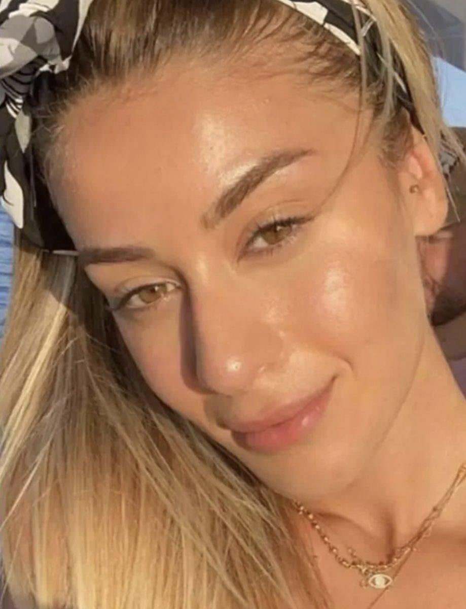 Acun Ilıcalı'nın sevgilisi Ayça Çağla Altunkaya'nın estetiksiz hali