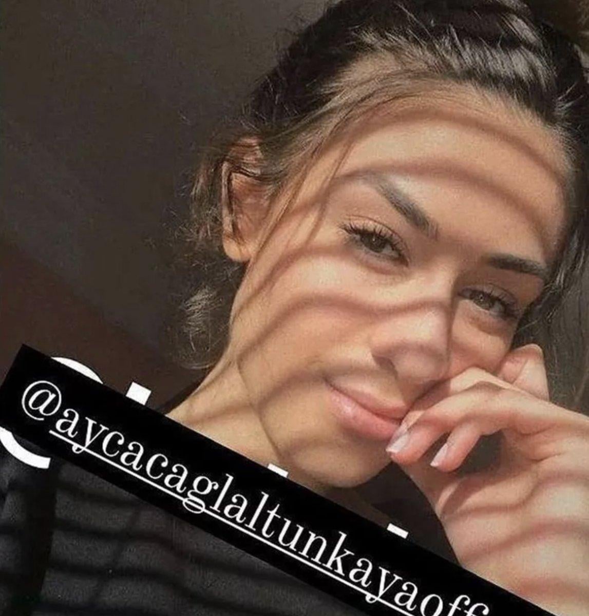 Acun Ilıcalı'nın sevgilisi Ayça Çağla Altunkaya'nın estetiksiz hali