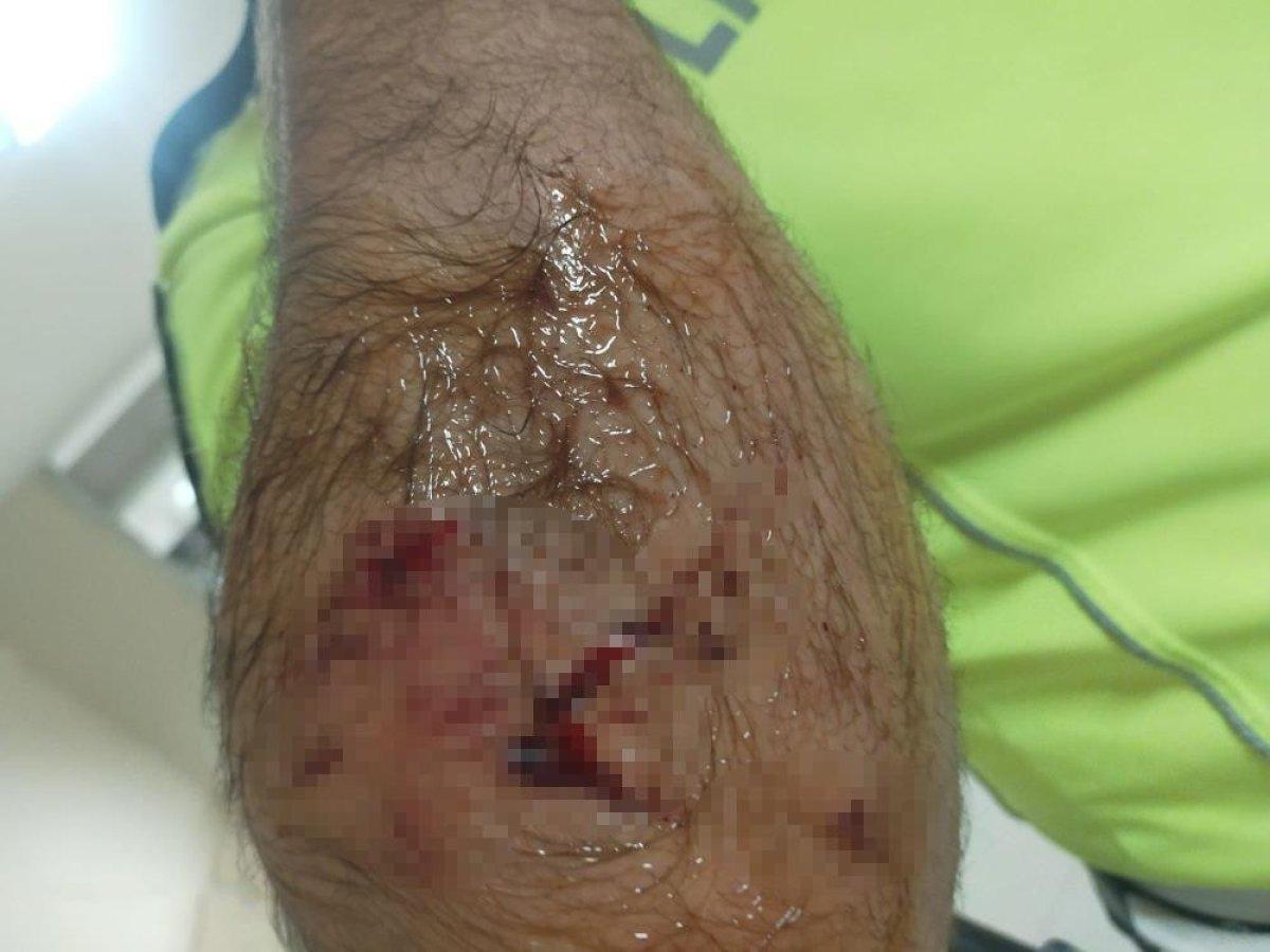 Denizli’de alkollü sürücünün engel olmadığı köpeğinin polisi ısırma anı