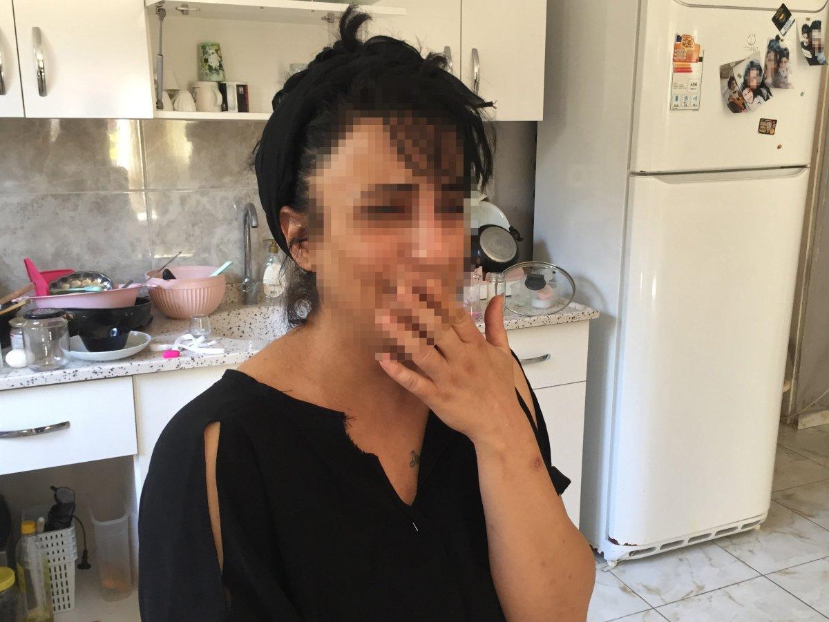 Adana'da 1 ay önce doğum yapan kadın sevgilisinden dayak yedi