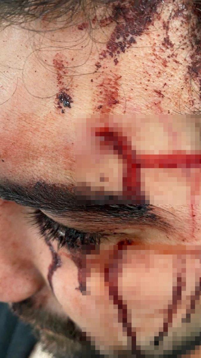 Üsküdar'da akrabaları tarafından asma kilitle darbedildi