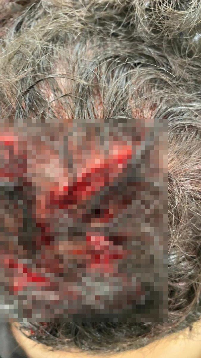 Üsküdar'da akrabaları tarafından asma kilitle darbedildi