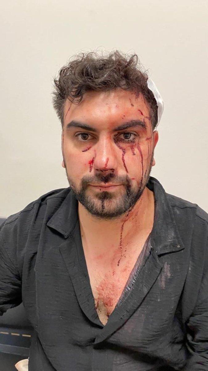 Üsküdar'da akrabaları tarafından asma kilitle darbedildi