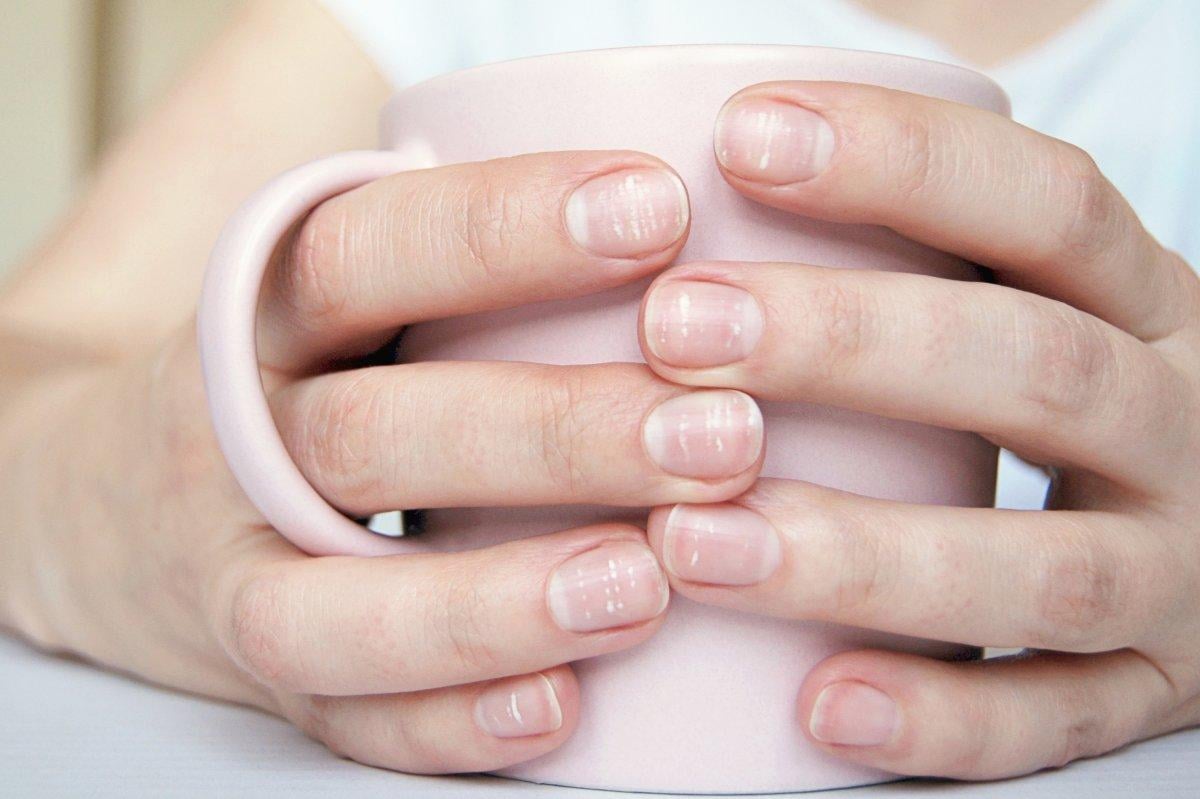 Tırnaklarda hafife alınmaması gereken işaretler