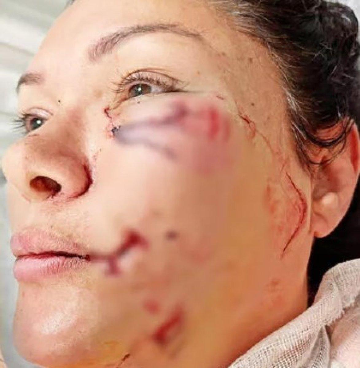 Sevda Demirel, Tuğba Altıntop’a köpeğin saldırdığına inanmadı