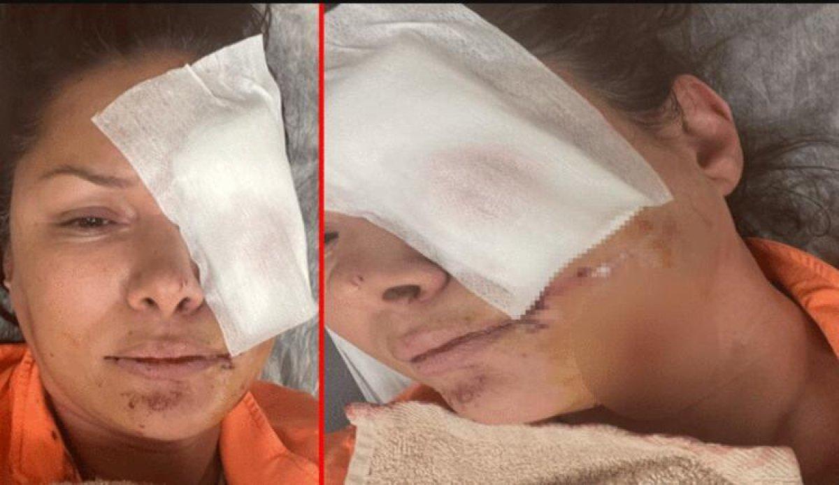 Sevda Demirel, Tuğba Altıntop’a köpeğin saldırdığına inanmadı