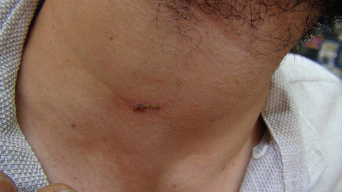 Kocaeli'de tente kumandası yüzünden tamirciyi dövdüler