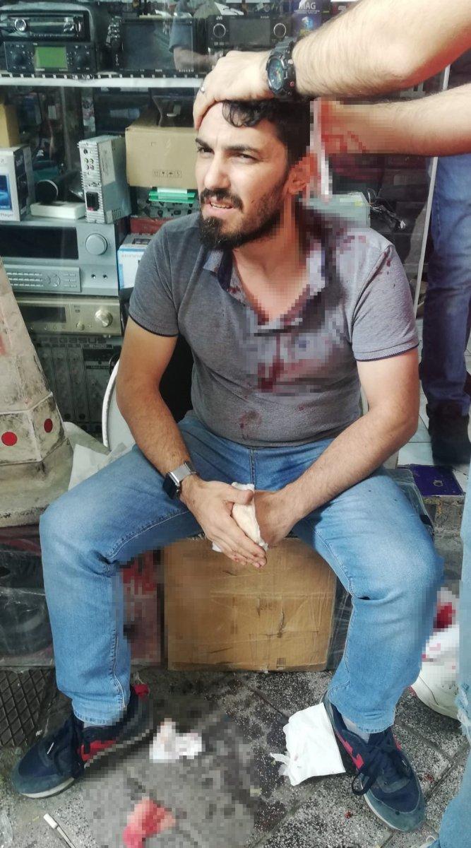 Kocaeli'de tente kumandası yüzünden tamirciyi dövdüler