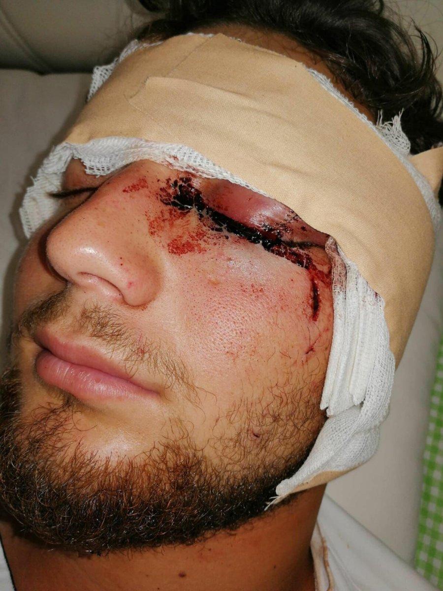 İzmir’de kavgayı ayırmak isterken gözünü kaybetti, adalet bekliyor