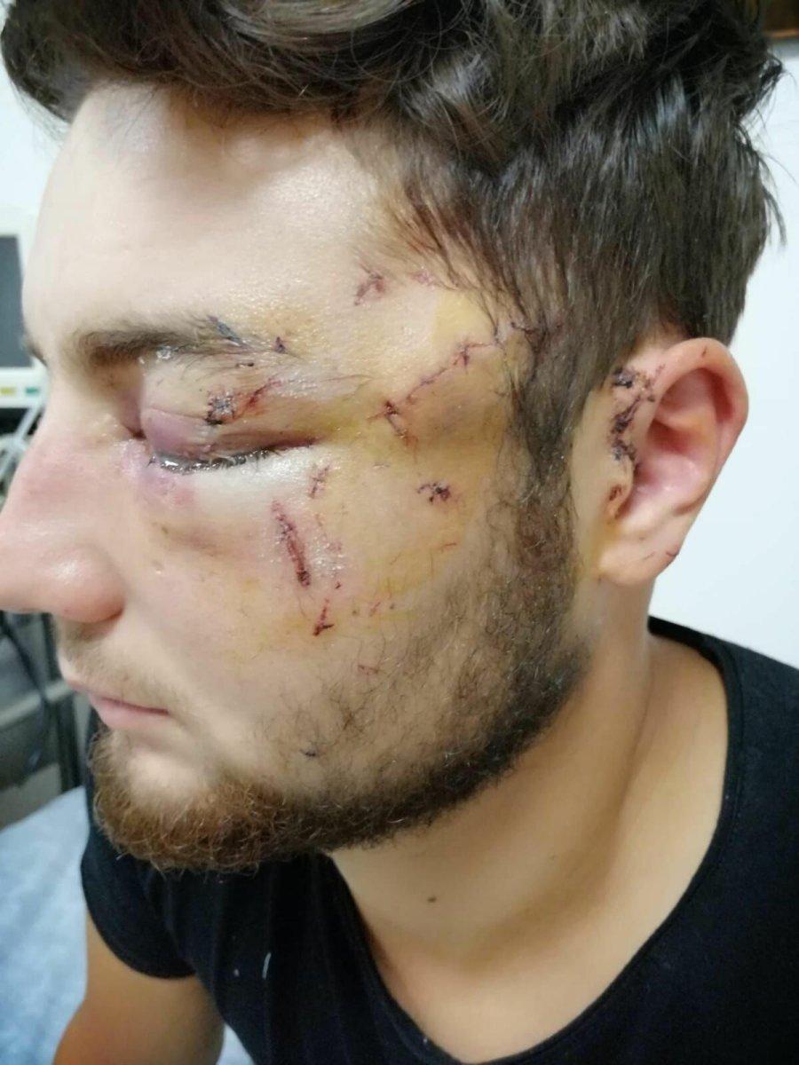 İzmir’de kavgayı ayırmak isterken gözünü kaybetti, adalet bekliyor