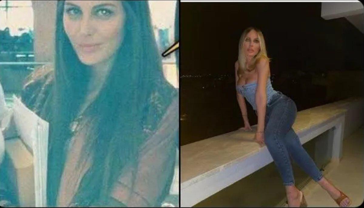 Hande Sarıoğlu'nun estetiksiz hali