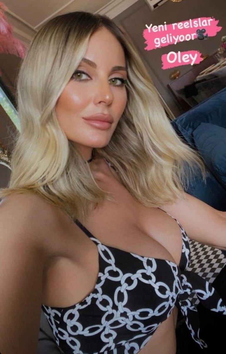 Hande Sarıoğlu'nun estetiksiz hali