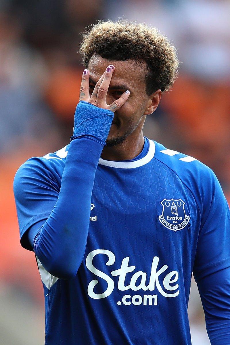 Dele Alli'nin yeni ojeleri