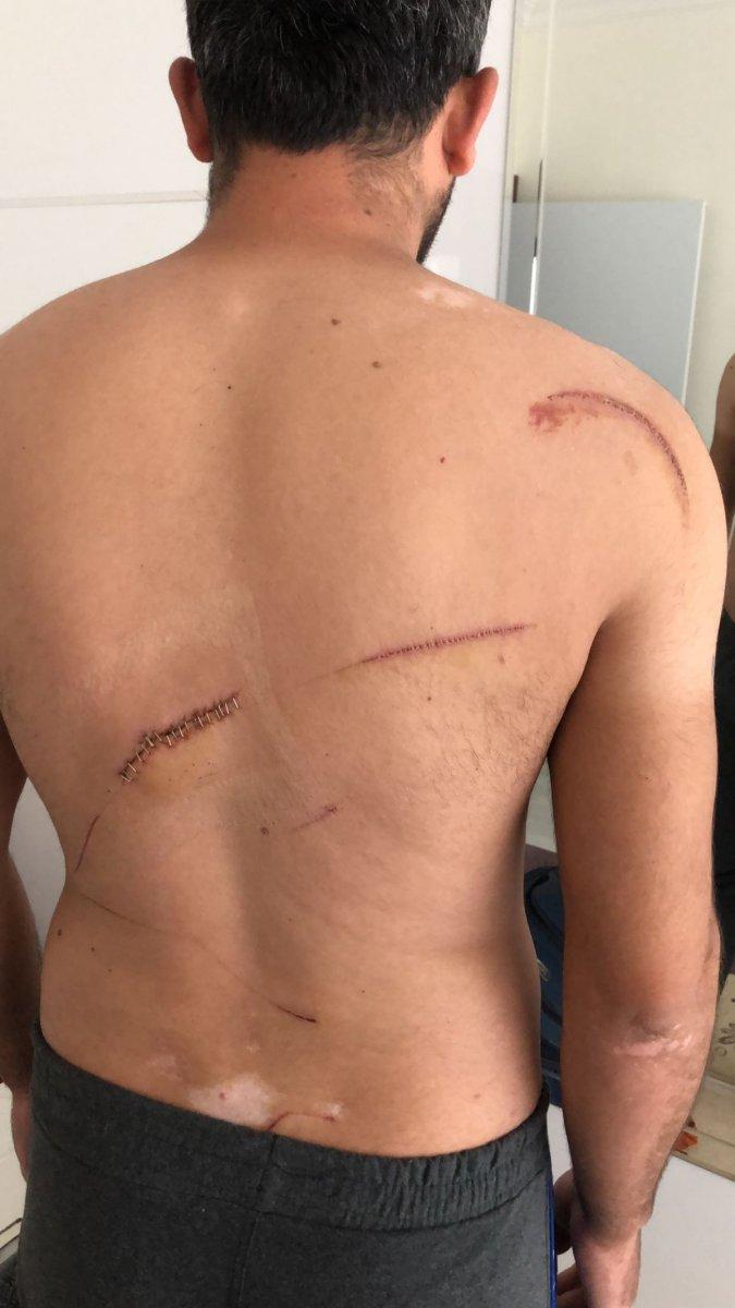 Ankara'da 6 satır darbesine 3 yıl hapis talebi